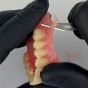 Villacryl Soft - Студенополимеризираща мека пластмаса за временно облицоване на акрилни протези